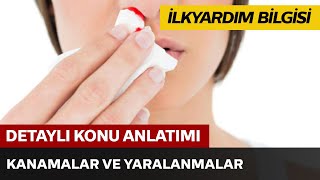 İlkyardım Bilgisi / Kanamalar ve Yaralanmalar