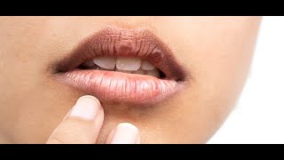 HOW TO TAKE CARE OF YOUR LIPS? || Chapped Lips | Dry Lips | Rough Lips |