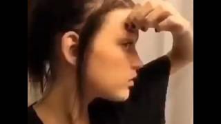 Отзывы Врача О Препарате Скинорен: Действие, Правила Использования, Побочное Действие, Аналоги