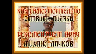 Как самостоятельно ставить пиявки.