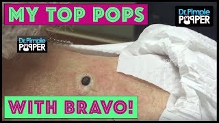 Dr. Sandra Lee Discusses Her TOP Pops with BravoTV.com