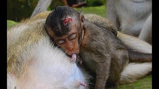 So Pity Pity ! Second time poor baby Lori got bad Problem With head, Baby get milk from mom.
