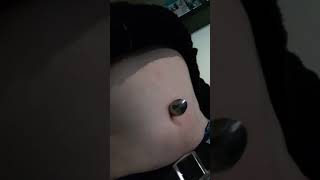 20181114 145825