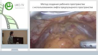 Аль Шукри А С - Экстраперитонеальная радикальная простатэктомия низкого давления
