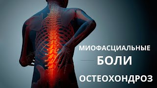 Миофасциальные боли и остеохондроз