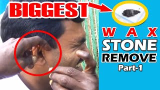 ►100% Safely Refreshed by Removing Hardest Big Wax (Part-1) II Job Done Perfectly & Feel Happy