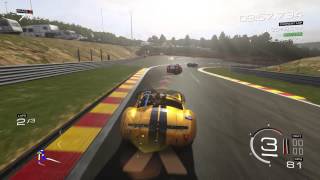 Forza 5 - 3 and Out race #1 - Mr Janke joins me for some B Class racing