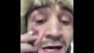 ЗУБАЙРА ТУХУГОВ О ДРАКЕ С КОНОРОМ ПОСЛЕ БОЯ С ХАБИБОМ !