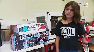 Nevers : des collégiennes ont réalisé une prothèse pour la petite Camille