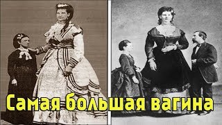 САМАЯ БОЛЬШАЯ ВАГИНА ВО ВСЕМ МИРЕ