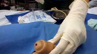 Cateterismo vesical / Urinary catheter