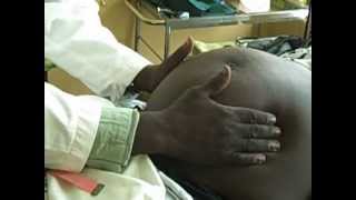 Obstetrics and Gynaecology - Examination of the Pregnant Woman Examination of the pregnant abdomen