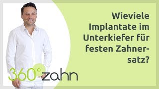 Wie viele Implantate im Unterkiefer für festen Zahnersatz? | Fragen & Antworten - 360°zahn