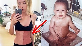 This Woman Swallowed Her Twin In The Womb And It Made Her Look Strange