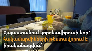 Հայաստանում կորոնավիրուսի նոր` հարկամարմինների թեստավորում է իրականացվում