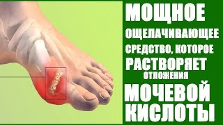 Выводит мочевую кислоту из организма при подагре