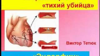 ***Как избавиться от атеросклероза? Эндорфинотерапия.