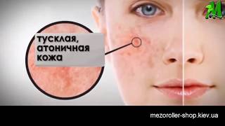 Ультразвуковой аппарат KD 8020 для омоложения.  Ультразвуковая чистка лица