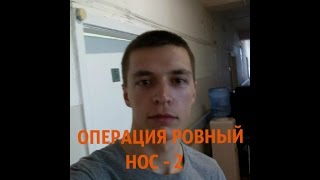 Исправление НОСОВОЙ ПЕРЕГОРОДКИ / Часть 2. Перед операцией на нос.