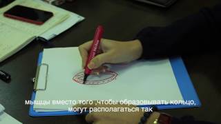 Как проходит операция по сужению влагалища нитью