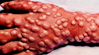 САМЫХ ОПАСНЫХ ВИРУСОВ