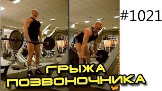 Упражнения для позвоночника, осанки, лечебная гимнастика при грыже позвоночника,