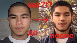 Что стало с моей бородой после 2 флаконов миноксидила?!?