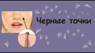 Черные точки. Как убрать черные точки на лице.