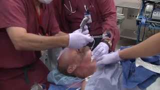 KingVision Channel and Standard blades in a bloody airway from AOD