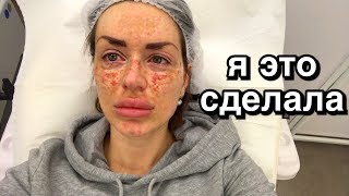 ПЕРВАЯ ПРОЦЕДУРА | борьба с пигментацией началась