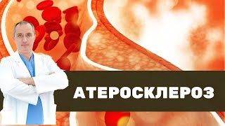 ❤ Что такое атеросклероз на самом деле