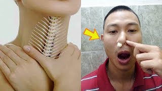 Mẹo chữa hóc xương cá cực kỳ đơn giản mà không phải tốn tiền đi gặp bác sĩ