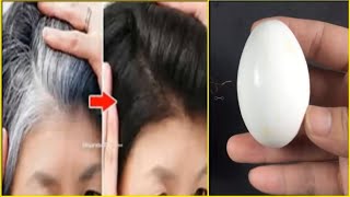 Với 1 quả trứng gà, tóc bạc trắng đầu cũng được phủ đen nhánh [mẹo sức khỏe]