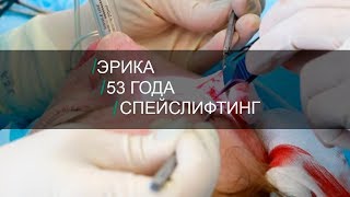 Спейслифтинг. Дорога пациента к новой жизни