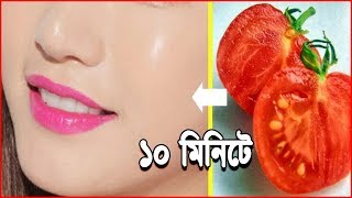 টমেটো দিয়ে ব্রণের পুরাতন দাগ দূর করুন মাত্র ১০ মিনিটে? Remove Old Spots of Acne