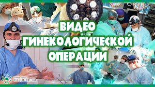 Трансвагинальная гистерэктомия