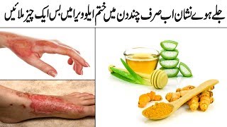Jale Huwe Nishan Ko Khatam Karne Ka Nihayet hi Asaan Nuskha