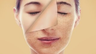 اقوى خلطة طبيعية لتصفيه وتبييض البشرة والتخلص من التجاعيد في اسبوع