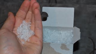 Не Медлите! Пачка СОЛИ спасет СУСТАВЫ. Даже запущенные случаи