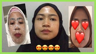 LASER FRACTIONAL CO2 DI AIRIN SKIN CLINIC