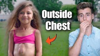 Meet The Girl Who Was Born With Her Heart Outside Her Chest