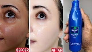 Facial Whitening, Uneven Skin Tone Results Within One Hour, Home Remedies
