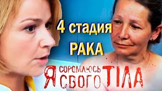 Третью стадию рака лечат с помощью народной медицины | Обзор | Я стесняюсь своего тела