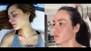 Diosa Canales y Osmariel Protagonizan la PELEA  del año.