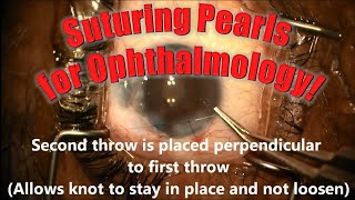 How to Suture Efficiently in Ophthalmology. Chris Teng, MD