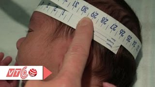 Theo dõi kỹ chỉ số vòng đầu của thai nhi  | VTC