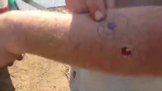 Une Bille De Paintball Dans Le Bras