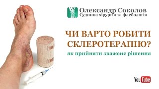 Стоит ли делать склеротерапию? Как принять взвешенное решение