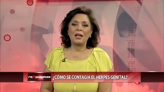 ¿Cómo se contagia el herpes genital?