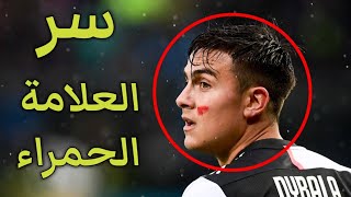 هل تعلم سبب وجود العلامة الحمراء على وجوه لاعبي وحكام الدوري الإيطالي؟